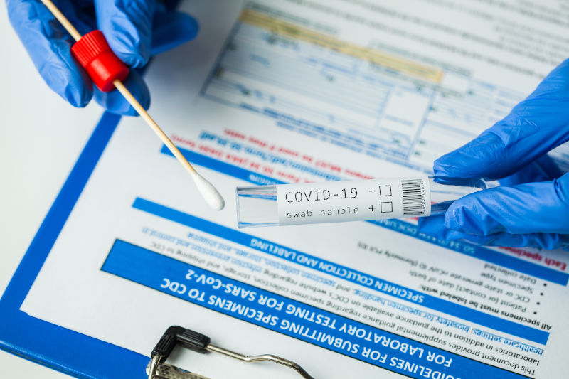 PCR Test